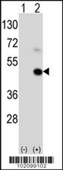 MAGEA9 Antibody (Center)