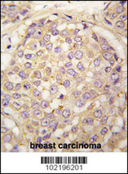 MAGEA4 Antibody (N-term)