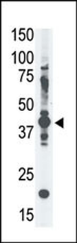 MAGEA4 Antibody (N-term)