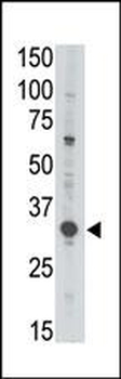 MAGEA3 Antibody (C-term)