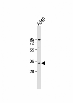 MAGEA2 Antibody (N-term)