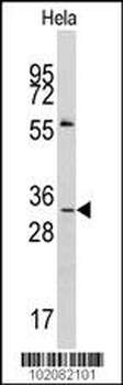MAGEA1 Antibody (Center)