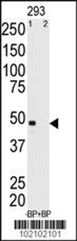 MAGEA11 Antibody (N-term)