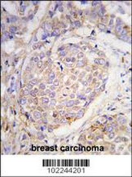 MAGEA10 Antibody (C-term)