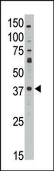 MAGEA10 Antibody (C-term)