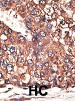 Leptin Receptor (LEPR) Antibody (N-term)