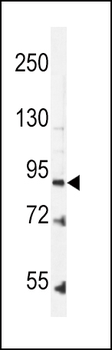 Leptin Receptor (LEPR) Antibody (N-term)