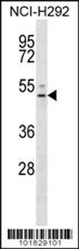 EDG6 Antibody (N-term)