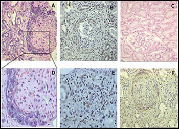 GREMLIN Antibody (C-term)