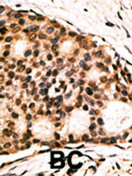CDX1 Antibody (C-term)