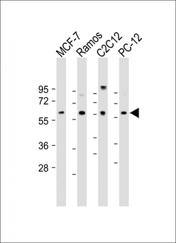 XIAP (BIRC4) Antibody (N-term)