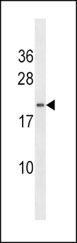HAND2 Antibody (C-term)