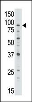 ABCB7 Antibody (C-term)