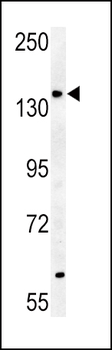 ABCB4 Antibody (Center)