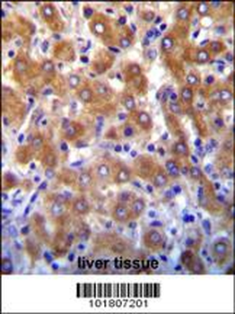 ABCB10 Antibody (N-term)