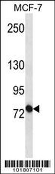 ABCB10 Antibody (N-term)