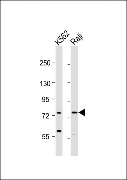 ABCB10 Antibody (N-term)