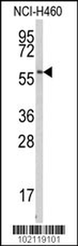 BACE1C Antibody (Center)