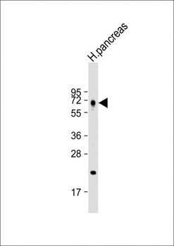 BACE1C Antibody (Center)