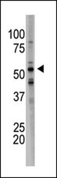 BACE1B Antibody (Center)