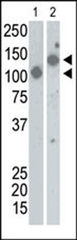 SARS virus Sn Antibody