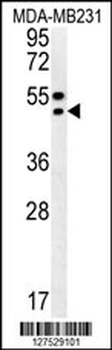 TRAM2 Antibody (C-term)