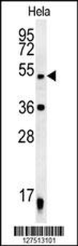 DDX47 Antibody (C-term)