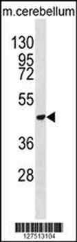 DDX47 Antibody (C-term)