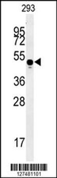 MYLK4 Antibody (C-term)
