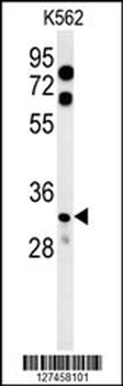 KCTD15 Antibody (C-term)