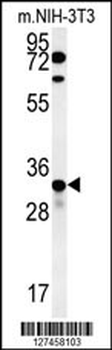 KCTD15 Antibody (C-term)