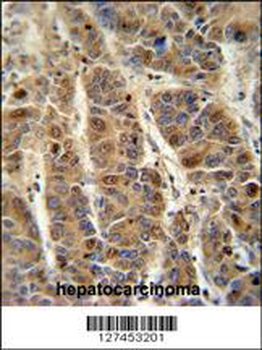 C4BPA Antibody (C-term)