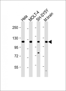 KIAA1688 Antibody (C-term)