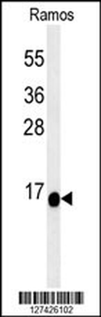 C1orf186 Antibody (C-term)