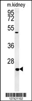 SHISA2 Antibody (C-term)