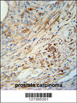 KIF9 Antibody (C-term)