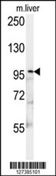 KIF9 Antibody (C-term)
