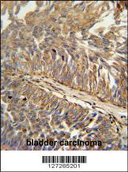 ATP13A3 Antibody (N-term)