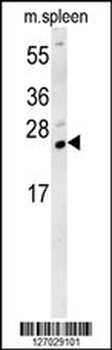 TMUB1 Antibody (Center)