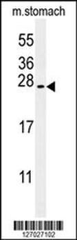 SRTD3 Antibody (N-term)