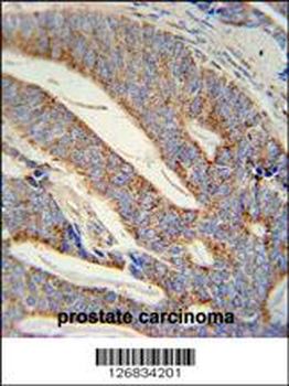 DACT1 Antibody (N-term)