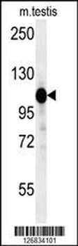 DACT1 Antibody (N-term)