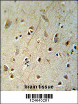 HEY2 Antibody (N-term)