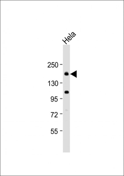 CLTC Antibody (Center)