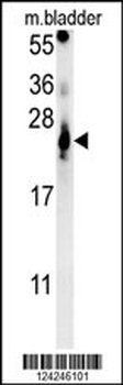 ATP5G2 Antibody (C-term)