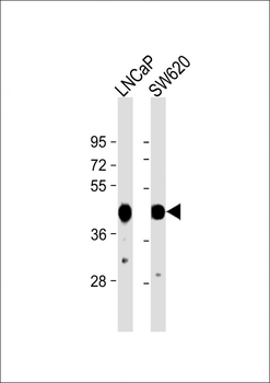 CS Antibody (N-term)