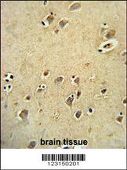 DIRAS3 Antibody