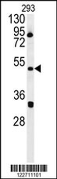 ILKAP Antibody (Center)