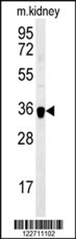 ILKAP Antibody (Center)