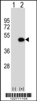 ILKAP Antibody (Center)